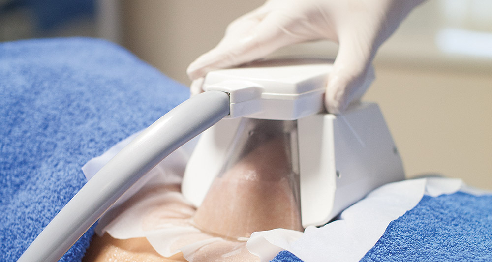 How Fat Freezing and HIFU Work Together? 2 Multiple Areas in One Session HIFU and Fat Freezing Calne
