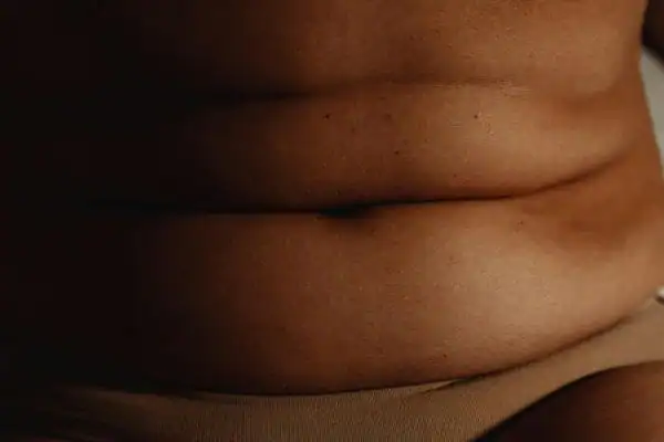 The Hidden Connection: How Stress Shapes Your Fitness and Body Composition 3 image of what stress can do on the stomach area and how Lipo 360 Calne can help to change your body shape.